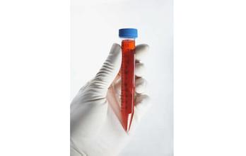 体表诊断试剂追求国产化