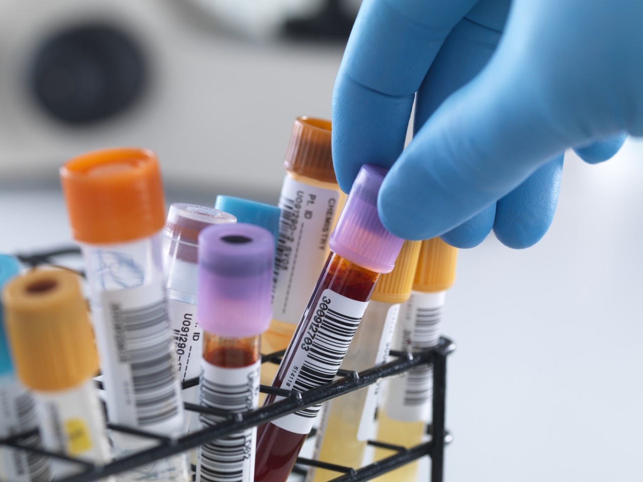 “溶出”还是“BE”，何为临床疗效“金尺度”