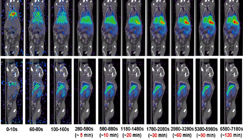 J9集团PET/CT分子影像技术平台