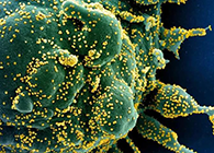 唾液检测新冠抗体新步骤来了，获取了局仅需几幼时！