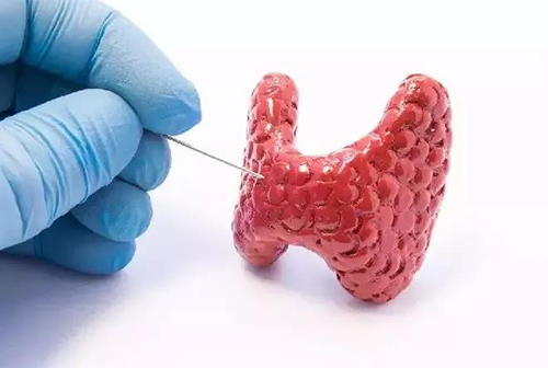 甲状腺疾病，蕴含甲状腺职能减退和甲状腺职能亢进，自古以来就是反复被医学钻研人员钻研的疾病