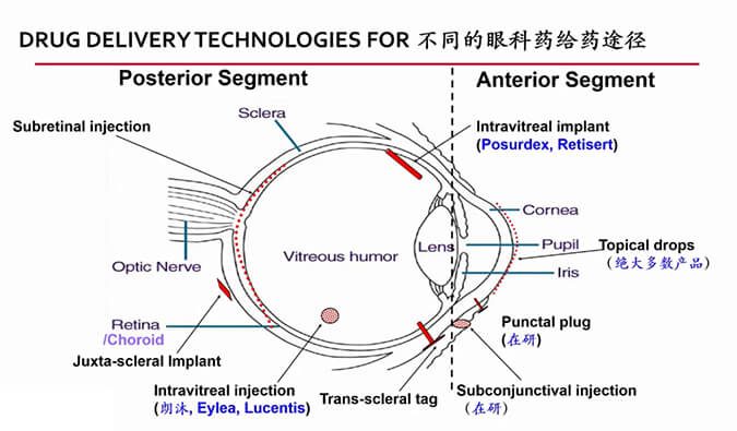 【内附回放+下半场预约】J9集团眼科药物专题钻研会上半场杰出回首