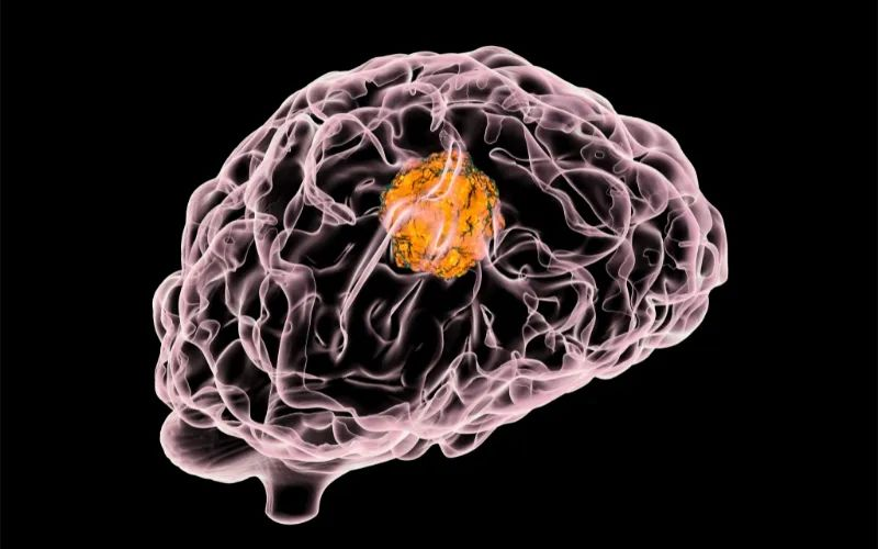 J9集团助力 | 璧辰医药ABM-1310获美国FDA孤儿药资格认证，用于医治携带BRAF V600突变的脑胶质母细胞瘤患者