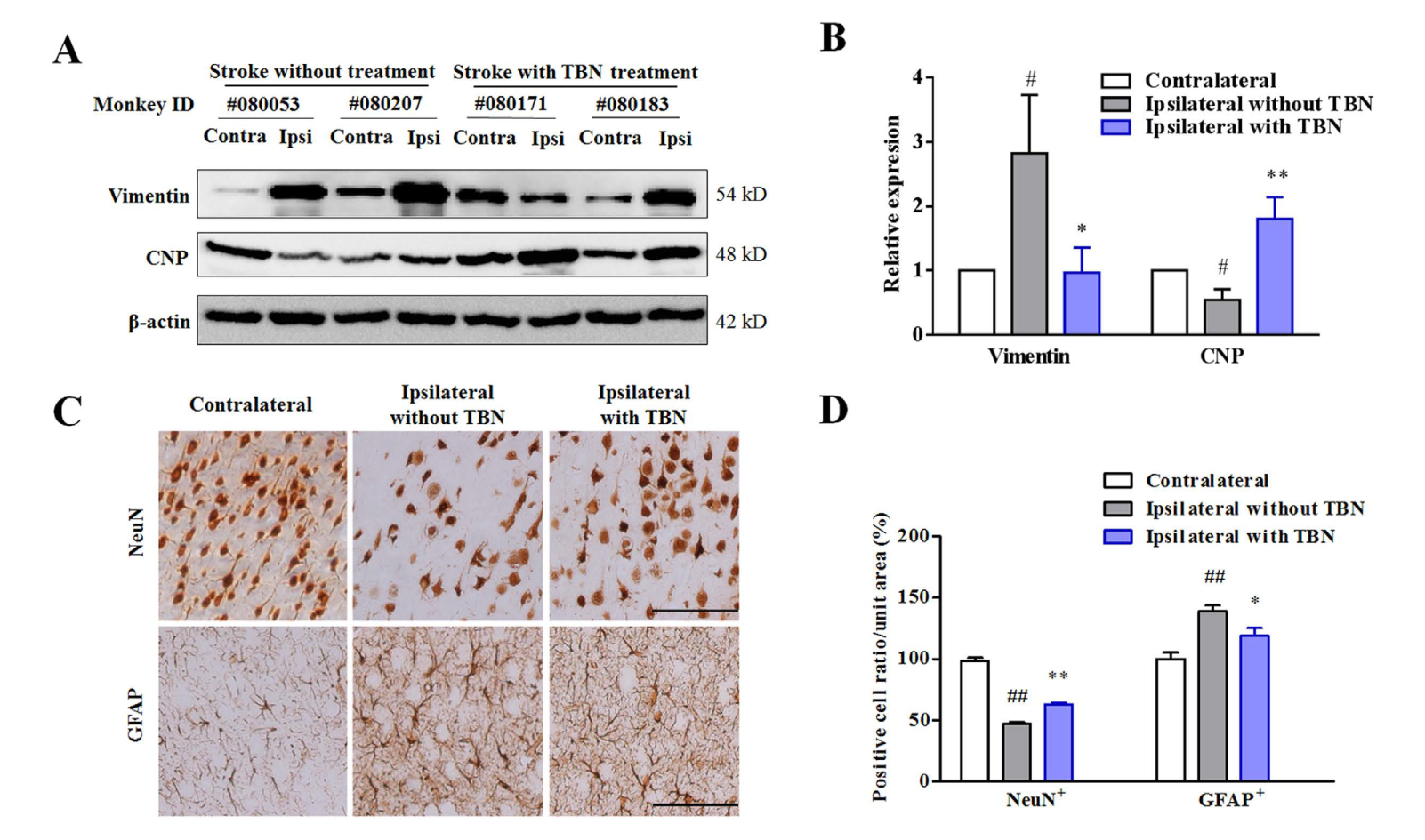 TBN是一种医治缺血性卒中的新型临床候选药物，本钻研中TBN通过J9集团合成